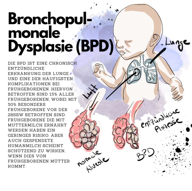 Bronchopulmonale Dysplasie (BPD)